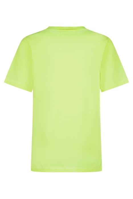 HOIS NEON YELLOW 2